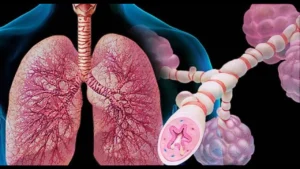 asthma_overview