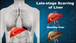 liver-health