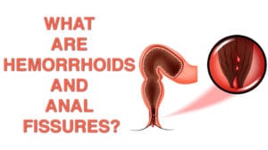 What are Hemorrhoids and Anal Fissures?