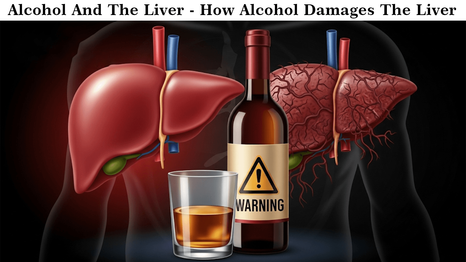 🍷 Alcohol And The Liver – How Alcohol Damages The Liver