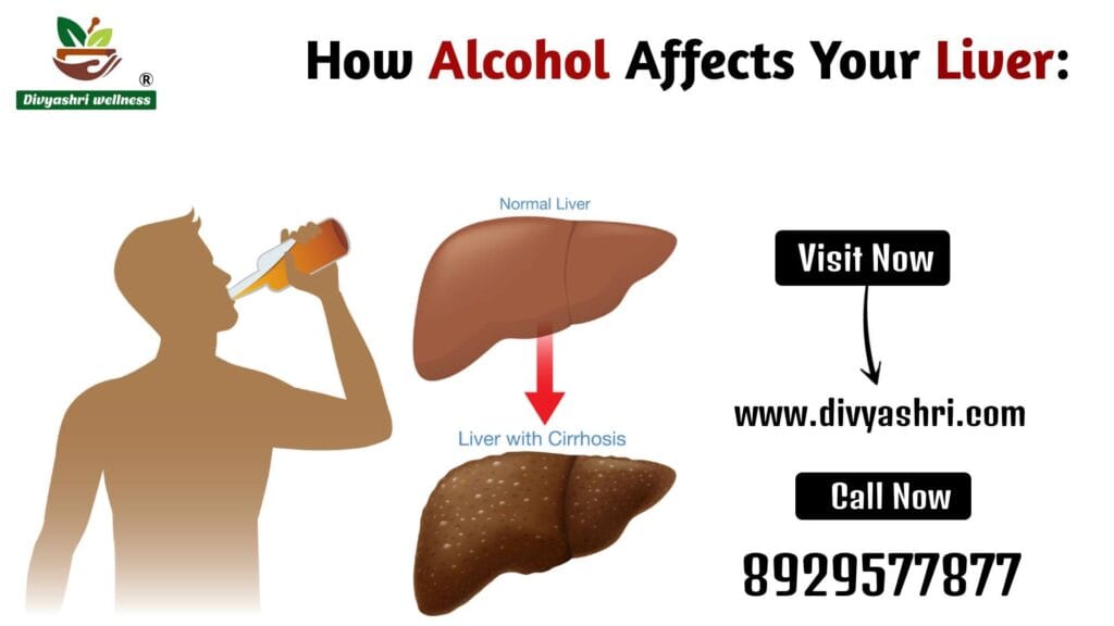 fatty liver